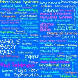 Finally diagnosed with Ehlers Danlos Syndrome